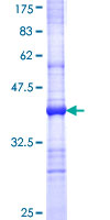 SDS-PAGE - Recombinant Human TLR6 protein (GST tag N-Terminus) (AB153069)