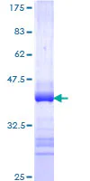 SDS-PAGE - Recombinant Human TLR7 protein (GST tag N-Terminus) (AB153341)