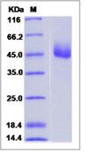 SDS-PAGE - Recombinant Human TM2D1/BBP protein (Fc Chimera) (AB276724), expandable thumbnail