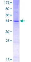 SDS-PAGE - Recombinant Human TM2D3 protein (GST tag N-Terminus) (AB164224)