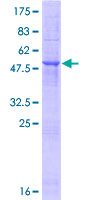 SDS-PAGE - Recombinant Human TMED6 protein (GST tag N-Terminus) (AB165536)
