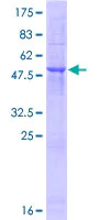 SDS-PAGE - Recombinant Human TMED6 protein (GST tag N-Terminus) (AB165536)