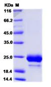 SDS-PAGE - Recombinant Human TMED9 protein (His tag) (AB276633)