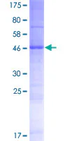 SDS-PAGE - Recombinant Human TMEM116 protein (GST tag N-Terminus) (AB164800)