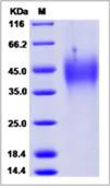 SDS-PAGE - Recombinant Human TMEM156 protein (His tag) (AB276690)