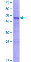 Recombinant Human Tmem27 protein