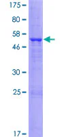 SDS-PAGE - Recombinant Human Tmem27 protein (GST tag N-Terminus) (AB132708)