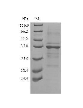 SDS-PAGE - Recombinant Human TMEM59 Protein (His Tag) (AB314625)