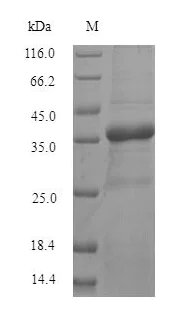 SDS-PAGE - Recombinant Human TMEM65 Protein (His Tag) (AB314626)