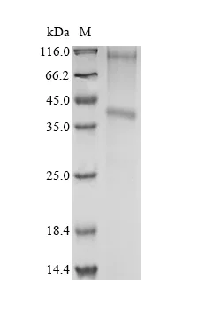 SDS-PAGE - Recombinant Human TMEM72 Protein (His Tag) (AB314627)