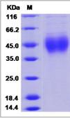 SDS-PAGE - Recombinant Human TMIGD1 protein (His tag) (AB276621)