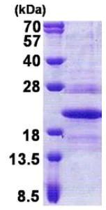 SDS-PAGE - Recombinant Human TMP21 protein (His tag N-Terminus) (AB167877)