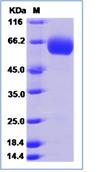 SDS-PAGE - Recombinant Human TMPRSS11B protein (His tag) (AB276696)