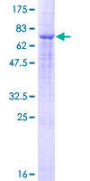Recombinant Human TMPRSS11D protein