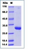 SDS-PAGE - Recombinant Human TMPRSS11D protein (His tag) (AB276496)