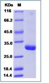 SDS-PAGE - Recombinant Human TMPRSS11D protein (His tag) (AB276496)
