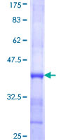 Recombinant Human TMPRSS13 protein