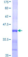 SDS-PAGE - Recombinant Human TMPRSS13 protein (AB164478)