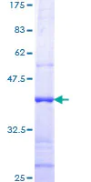 SDS-PAGE - Recombinant Human TMPRSS2 protein (AB112364)