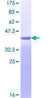 SDS-PAGE - Recombinant Human TMS1/ASC protein (Tag Free) (AB131786)