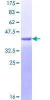 SDS-PAGE - Recombinant Human TMS1/ASC protein (Tag Free) (AB131786)