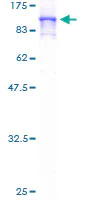 SDS-PAGE - Recombinant Human TN-X protein (AB159733)