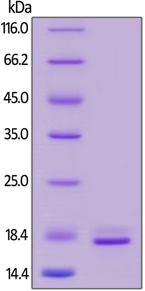 SDS-PAGE - Recombinant human TNF alpha protein (Active) (ab155699), expandable thumbnail