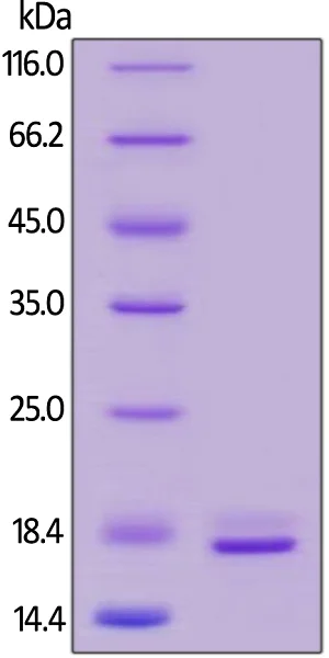 SDS-PAGE - Recombinant human TNF alpha protein (Active) (AB155699)