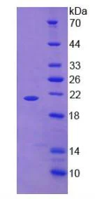 SDS-PAGE - Recombinant human TNF alpha protein (His tag) (AB270587)