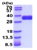 SDS-PAGE - Recombinant Human TNF Receptor II protein (His tag C-Terminus) (AB206800)
