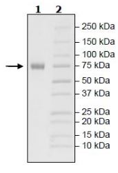 SDS-PAGE - Recombinant Human TNF Receptor II protein (Tagged) (Biotin) (AB271769), expandable thumbnail