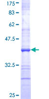 Recombinant Human TNFAIP2 protein