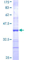 SDS-PAGE - Recombinant Human TNFAIP2 protein (AB159728)