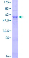 SDS-PAGE - Recombinant Human TNFAIP3 protein (GST tag N-Terminus) (AB132088)