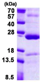 SDS-PAGE - Recombinant Human TNFAIP8 protein (His tag N-Terminus) (AB156983)