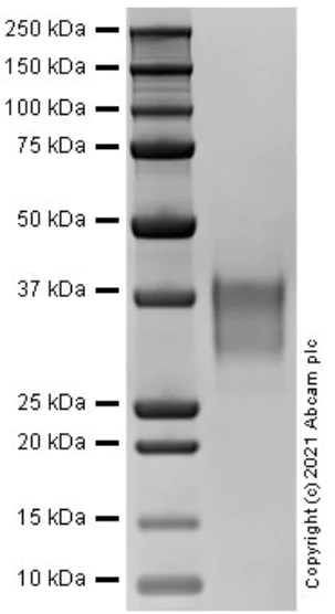SDS-PAGE - Recombinant Human TNFL8 Protein (AB283923)