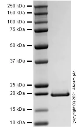 SDS-PAGE - Recombinant Human TNFL9 Protein (Active) (AB283931)