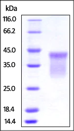 SDS-PAGE - Recombinant human TNFRSF14/HVEM protein (Active) (AB219714)