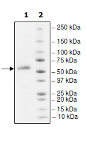 SDS-PAGE - Recombinant human TNFRSF14/HVEM protein (Active) (AB271546)