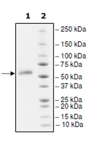 SDS-PAGE - Recombinant human TNFRSF14/HVEM protein (Active) (Fc tag C-Terminus) (AB271546)