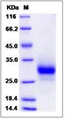 SDS-PAGE - Recombinant Human TNFRSF19 protein (His tag) (AB276535)