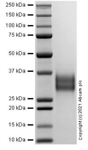 SDS-PAGE - Recombinant Human TNFRSF1A Protein (Active) (AB283448), expandable thumbnail