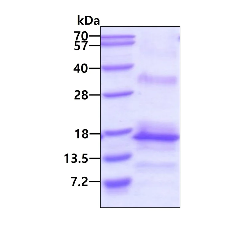 SDS-PAGE - Recombinant Human TNIP1 protein (AB101108)