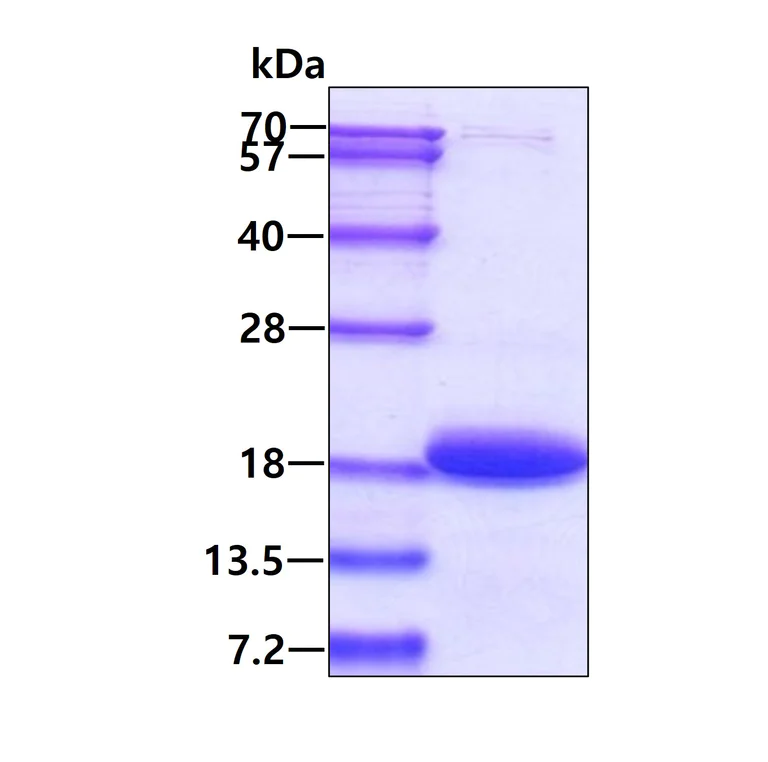 SDS-PAGE - Recombinant Human TNNC1 protein (AB113126)