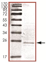 Recombinant Human TNNI1 protein