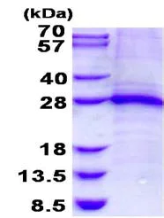 SDS-PAGE - Recombinant Human TNNI1 protein (denatured) (His tag N-Terminus) (AB136375)