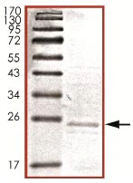 SDS-PAGE - Recombinant Human TNNI1 protein (AB125609)