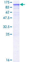 Recombinant Human TNNI3K protein