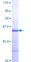 SDS-PAGE - Recombinant Human TNNI3K protein (AB162410), expandable thumbnail