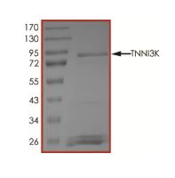 SDS-PAGE - Recombinant human TNNI3K protein (Active) (AB269059)
